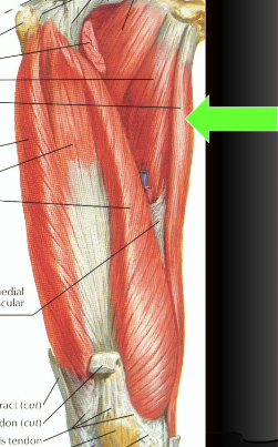 <p>O - Inferior pubic ramus</p><p>I - Anteromedial tibia via pes anserine tendon</p><p>A - Hip ADDuction, flexion</p><p>N - Obturator</p>