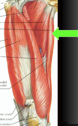 O - Inferior pubic ramus

I - Anteromedial tibia via pes anserine tendon

A - Hip ADDuction, flexion

N - Obturator