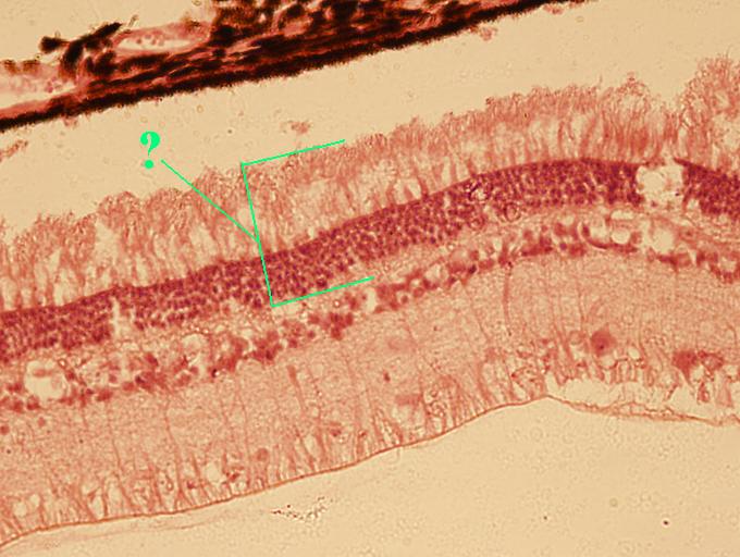 <p><span><span>Identify the indicated layer of the retina</span></span></p>