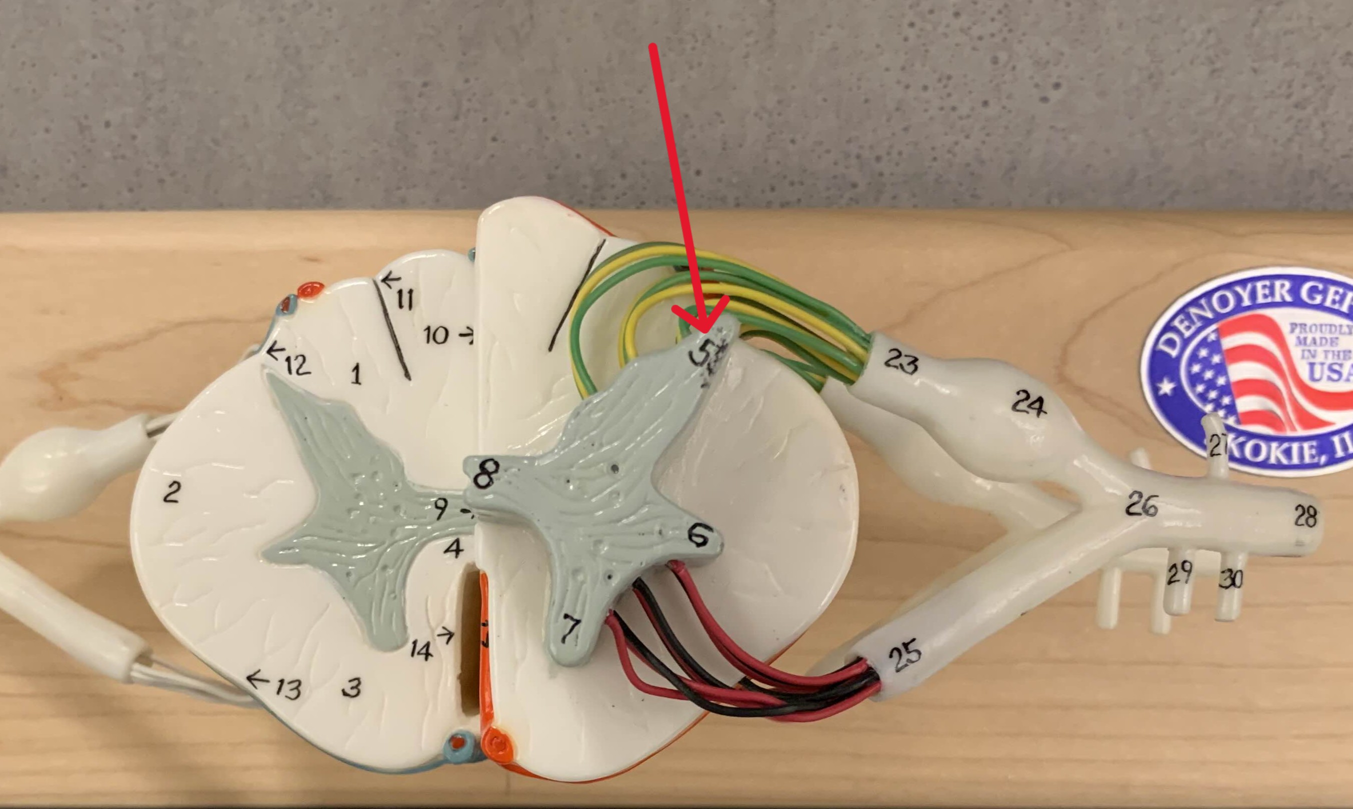 <p>Which gray horn of the spinal cord is:</p><ul><li><p>Gray and on posterior side</p></li><li><p>Contain somatic and visceral sensory nuclei</p></li></ul><p></p>