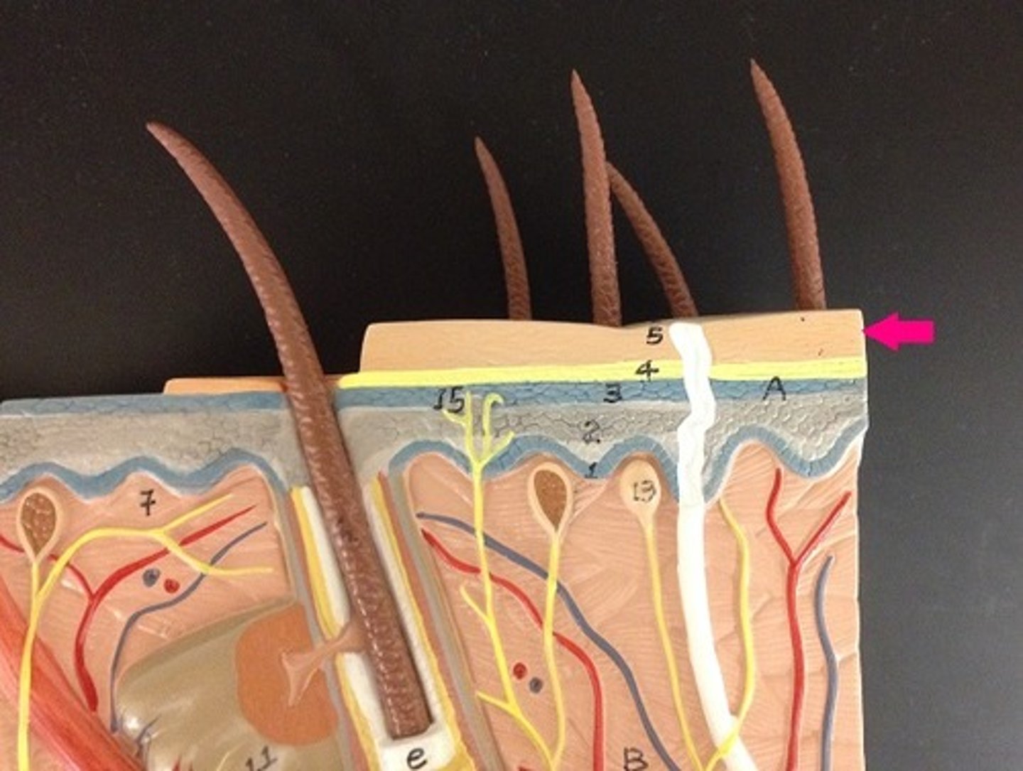 <p>outermost layer made of many layers of tough, tightly packed dead cells</p>