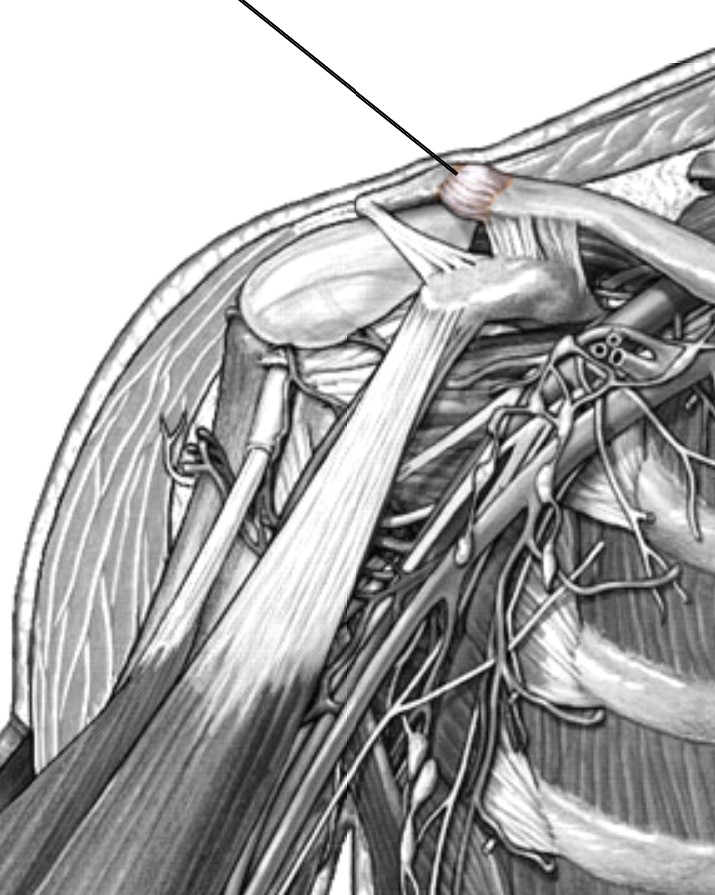 <p>Which ligament of the shoulder that connects between acromion and clavicle?</p>