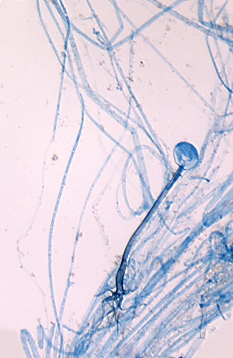 <p>Rhizopus spp. produce sporanigia borne on long sporanigiophores. Rhizoids are produced directly opposite the sporangiophore.</p>