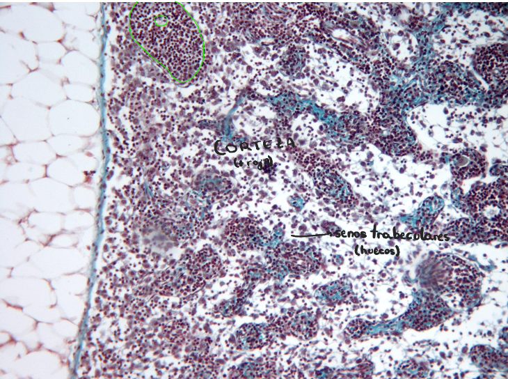 <p>Ganglio linfático</p><p>en verde - folículo linfático secundario con su centro germinativo</p>