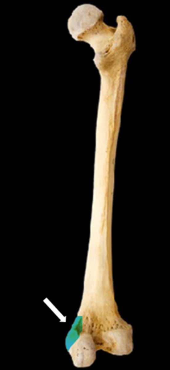 <p>name the part</p>