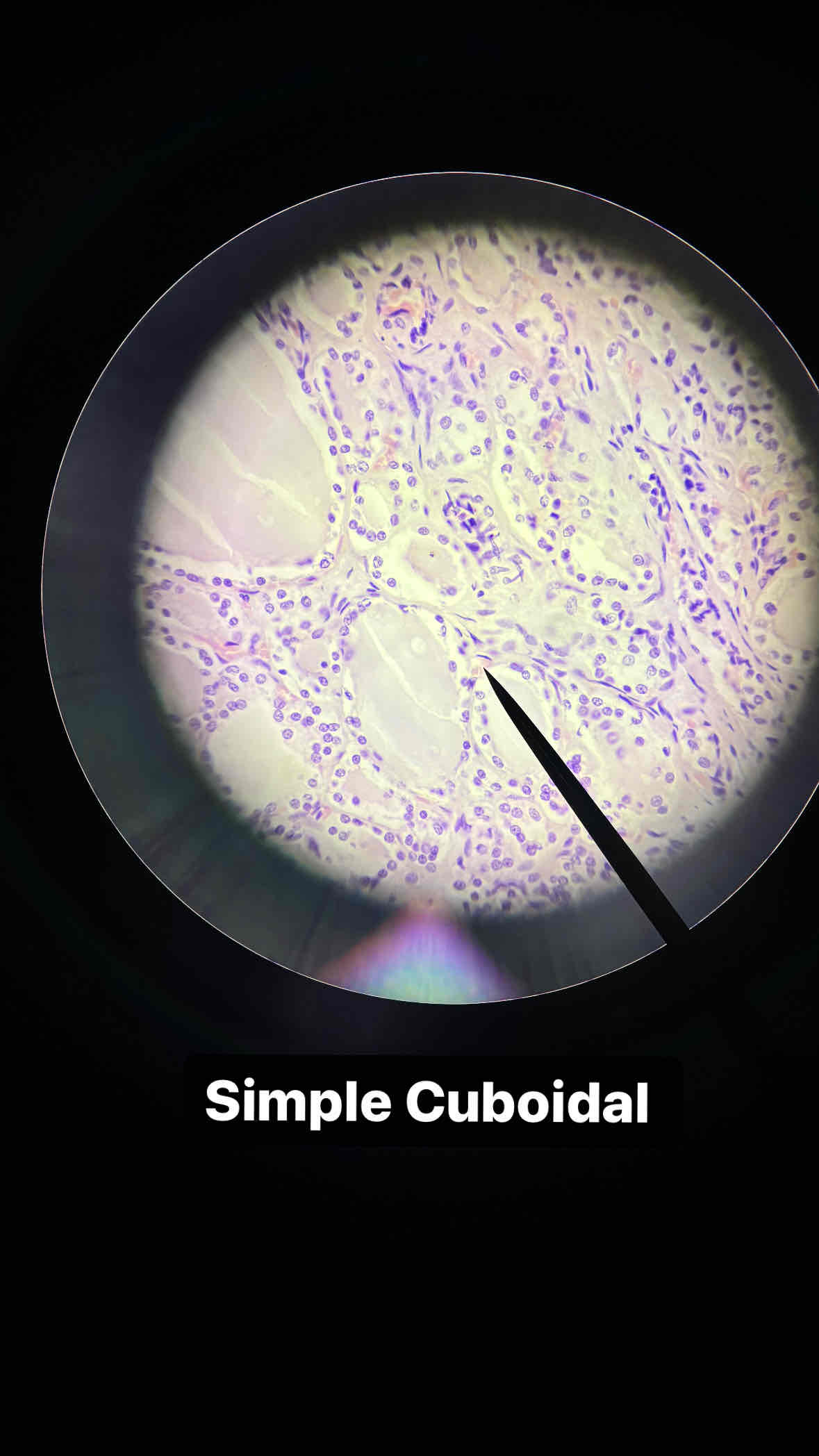 <p><span>type and subtype of tissue?</span></p>
