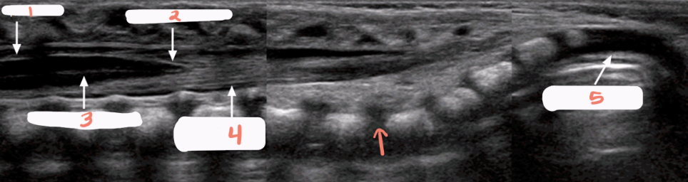 <p>is this spine normal?</p>
