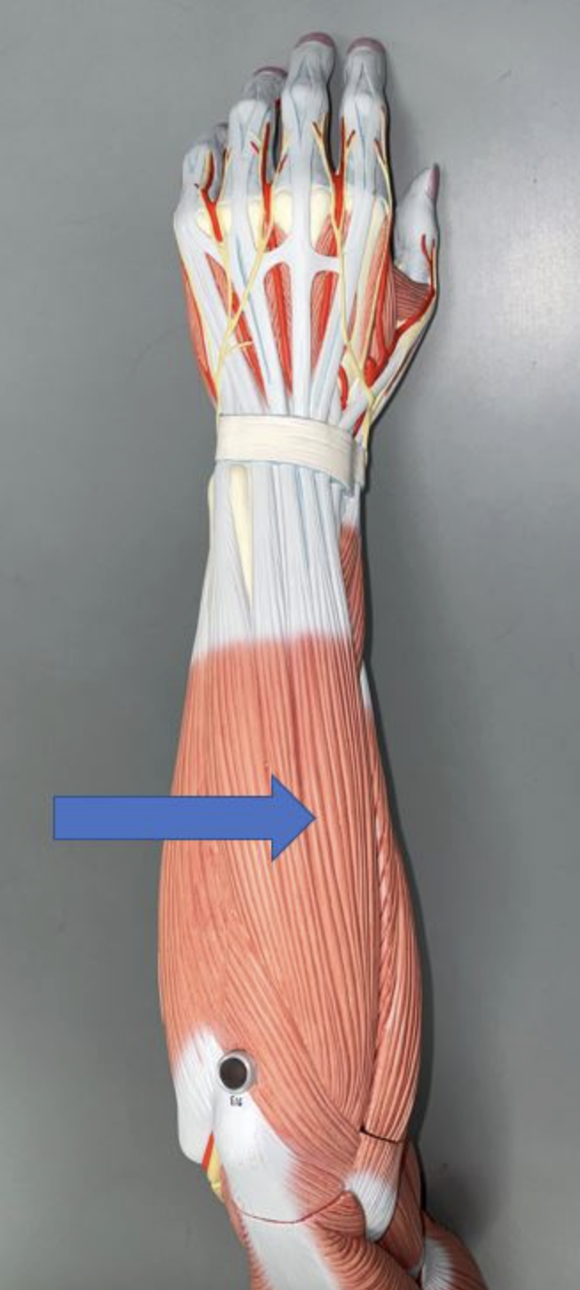 <p>muscle name & function</p>