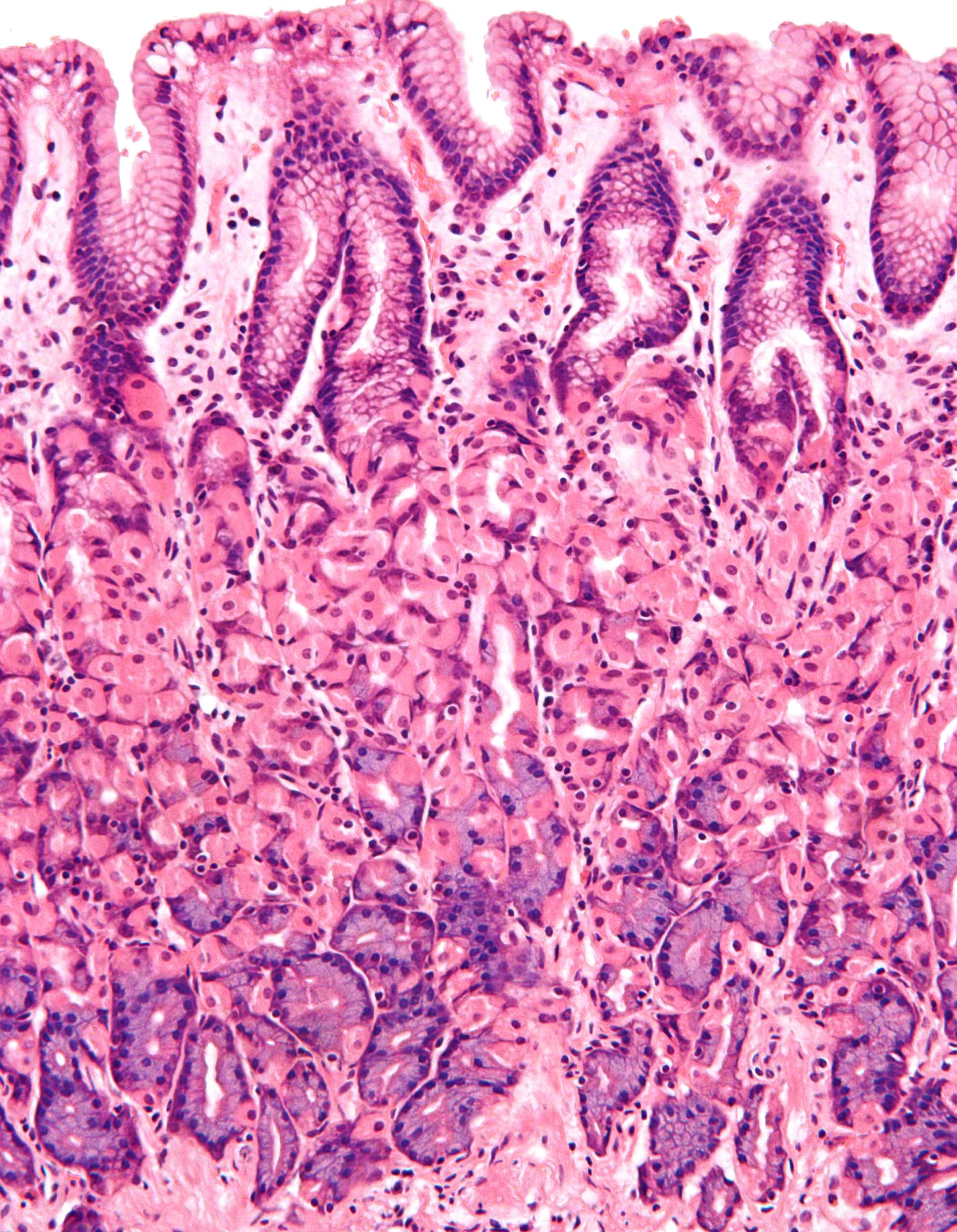 <p>simple columnar (epithelial)</p>