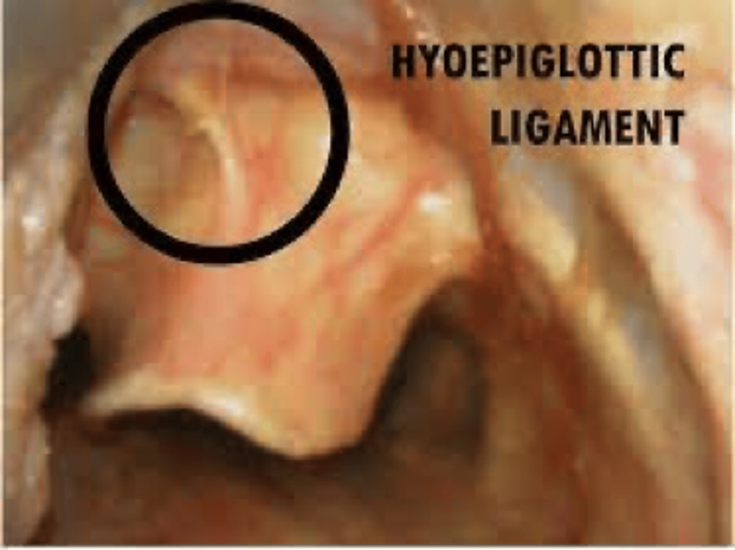 <p>push up and away tensing the hyoepiglottic ligament</p>