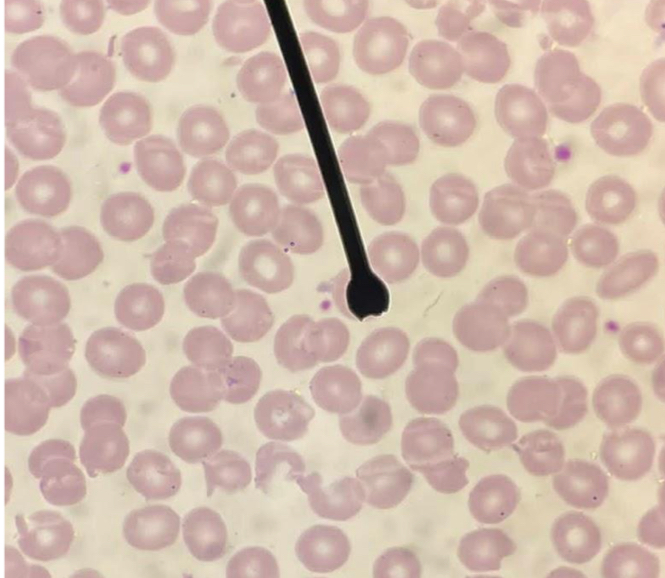<p>A. Identify the cell (Normoblastic / Rubriblastic )</p><p>B. Striking feature if stained with Romanowsky stains</p><p>C.  Characters structure responsible for its deformability and flexibility</p><p>D. Actual shape </p>