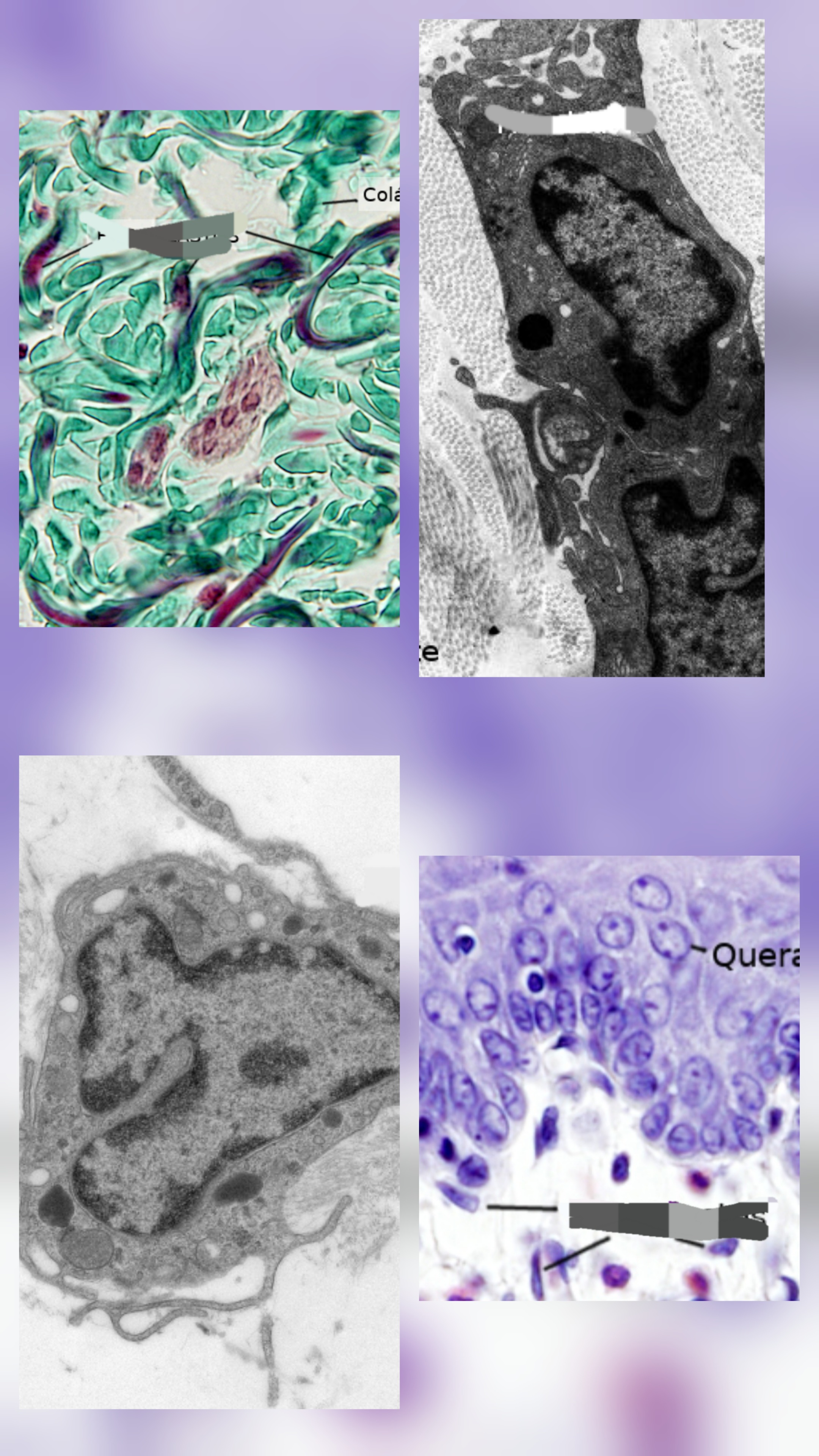 <p>Que tipo de celula es?</p>