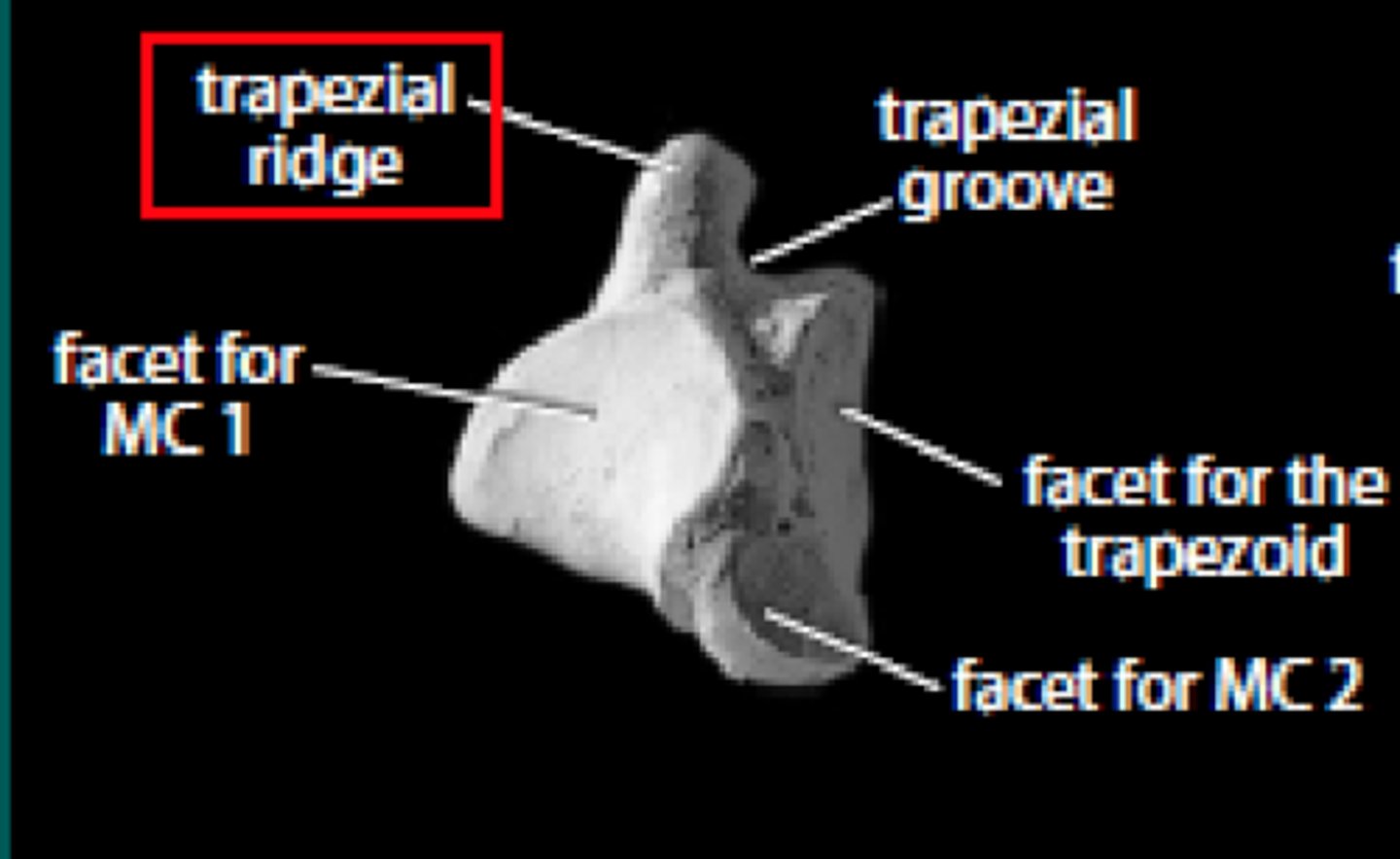 <p>A ridge on the trapezium bone that provides attachment for ligaments.</p>