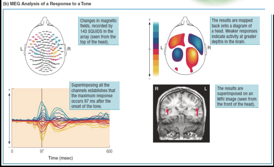 <p>The conductivity of the tissues inside the skull has little effect on the magnetic filed outside of the skull</p>