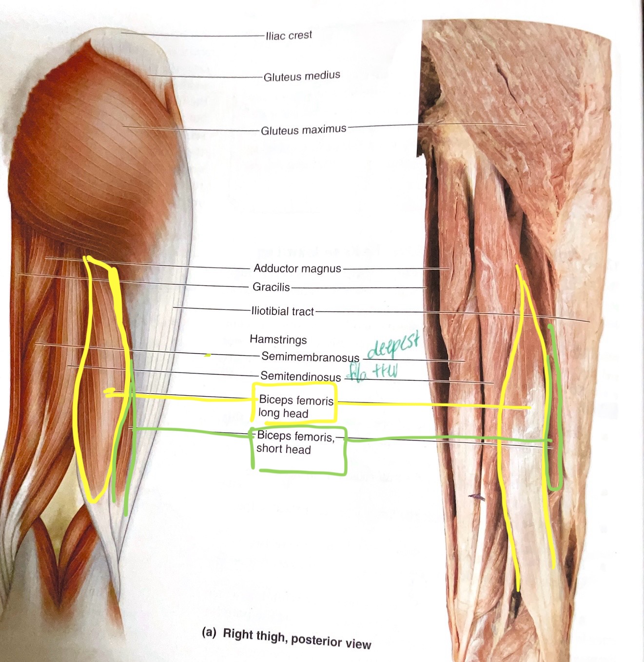 <p>Origin: Long head- ischial tuberosity; Short head- linea aspera. Insertion: head of fibula</p><p>Action:Long head- extend hip; flex hip</p>