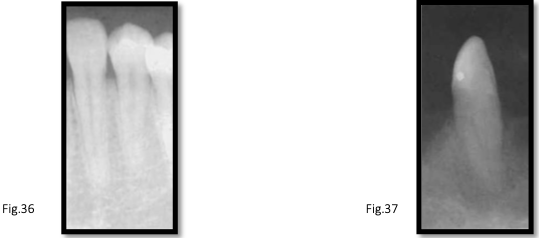 <p>canal anatomy of <strong>mn canines</strong></p>