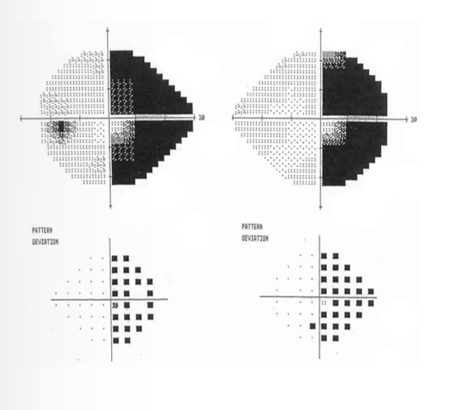 <p>What is this VF plot showing</p>