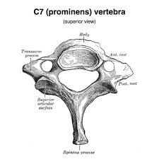 <p>-doesn’t have a bifid spinous process</p><p>-prominent spinous process</p><p>-large transverse process</p><p>-smaller accessory veins pass through the C7 foramen rather than the vertebral artery</p>