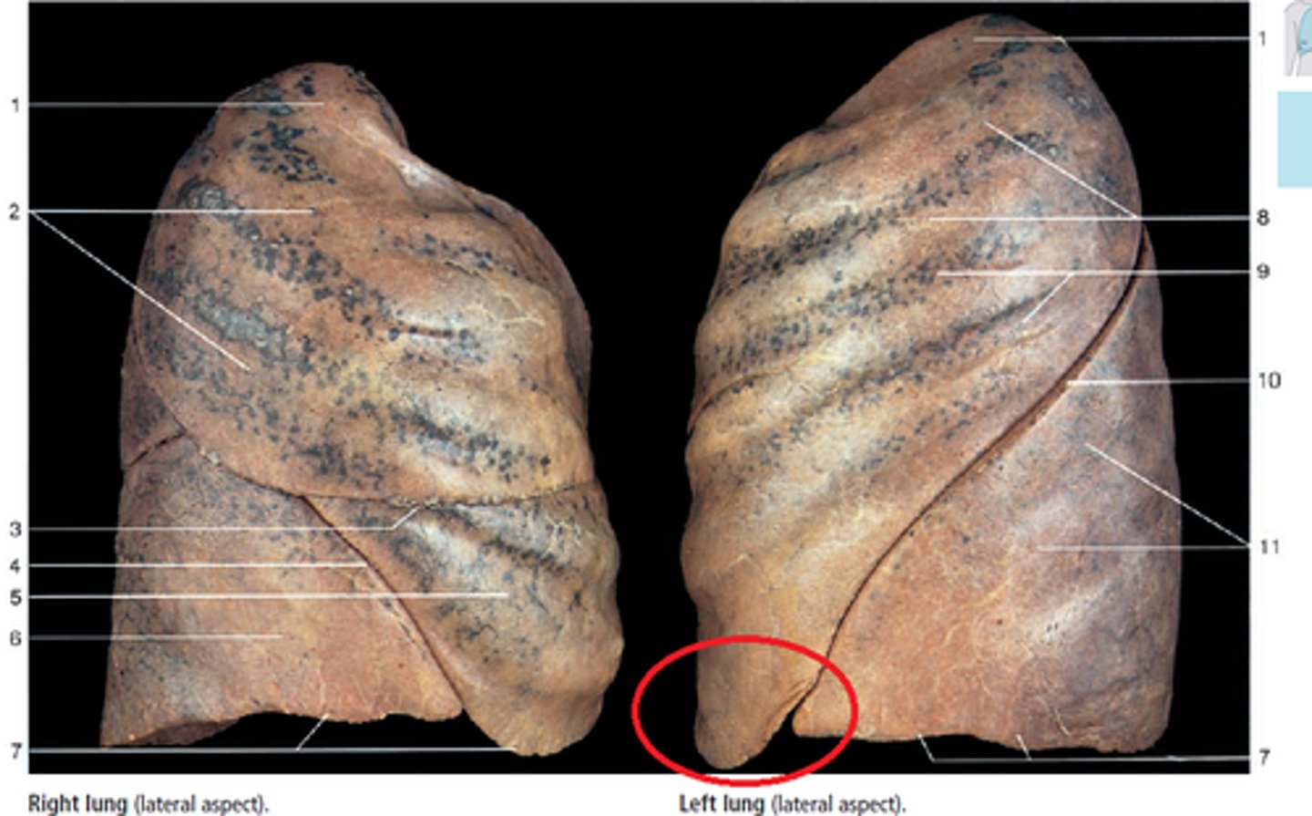 <p>The region of the left lung that corresponds with the right middle lobe.</p>
