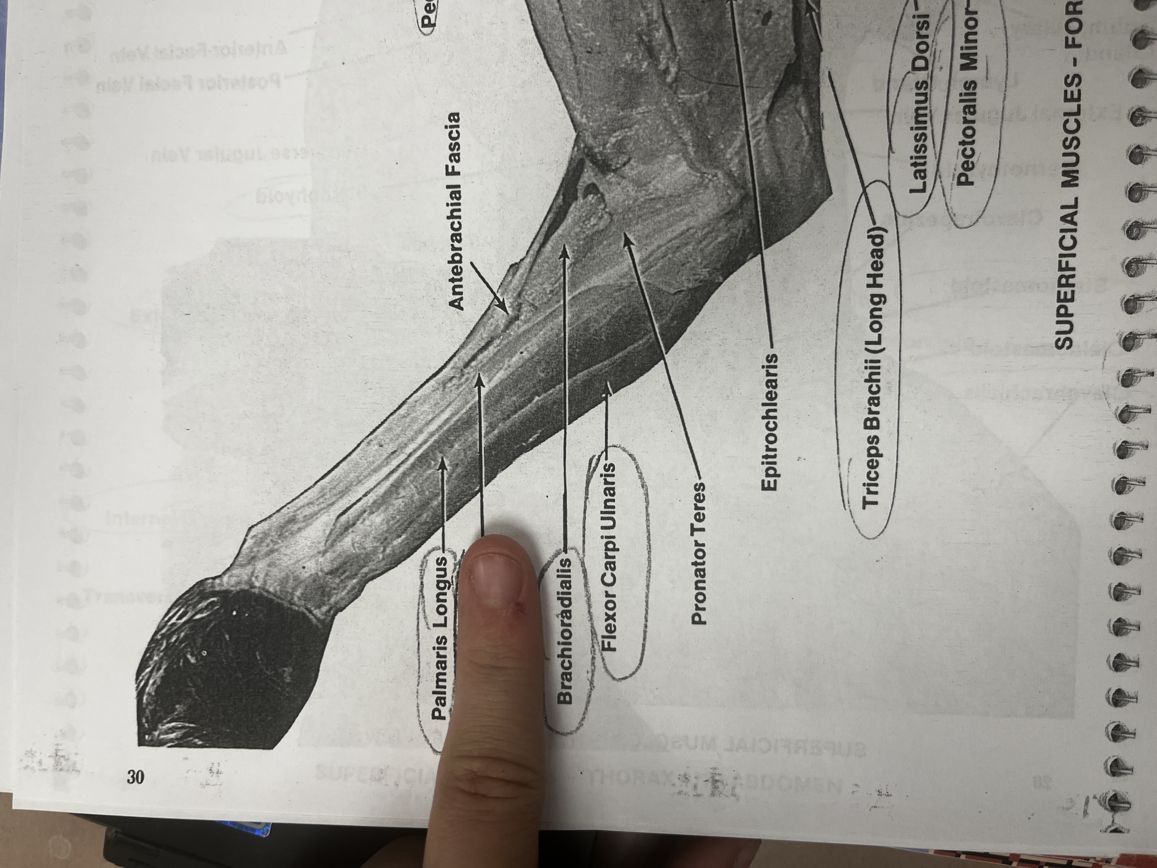 <p>A muscle in the forearm that flexes the wrist.</p>