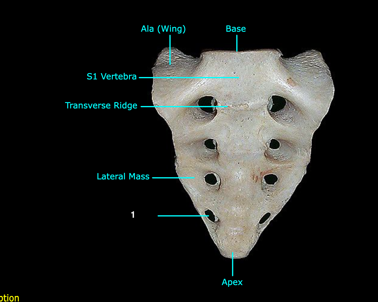 <p>What structure is labeled 1?</p>