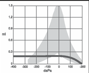 <p>what type of tympanogram is this and what would it typically suggest</p>