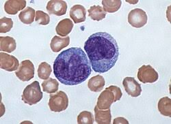 <p>monocyte</p>