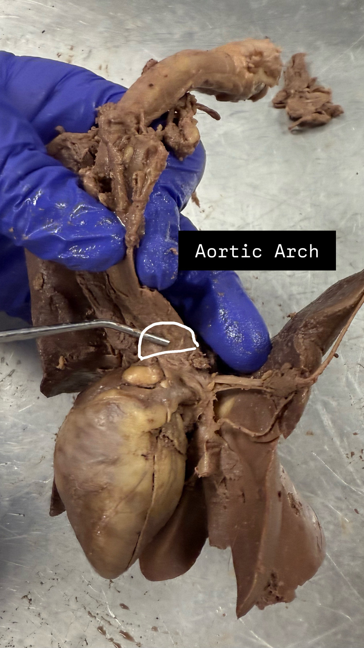<p>Aorta Arch</p>