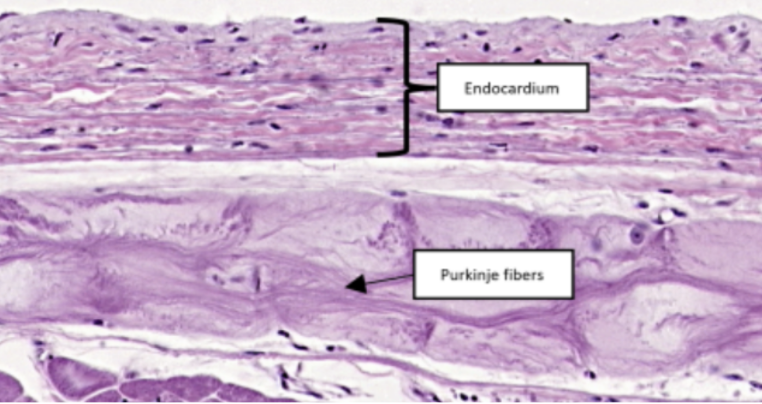 <p>In this slide specimen, this is a simple squamous epithelium that lines the luminal surface of the heart and blood vessels.</p>