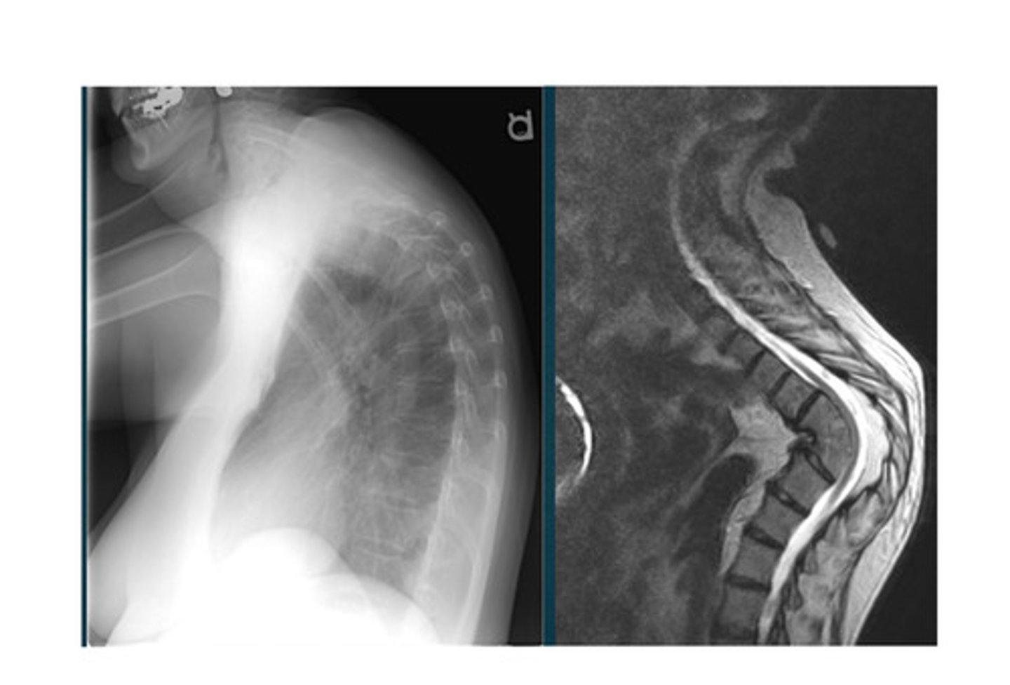 <p>What do we see in this projection?</p>