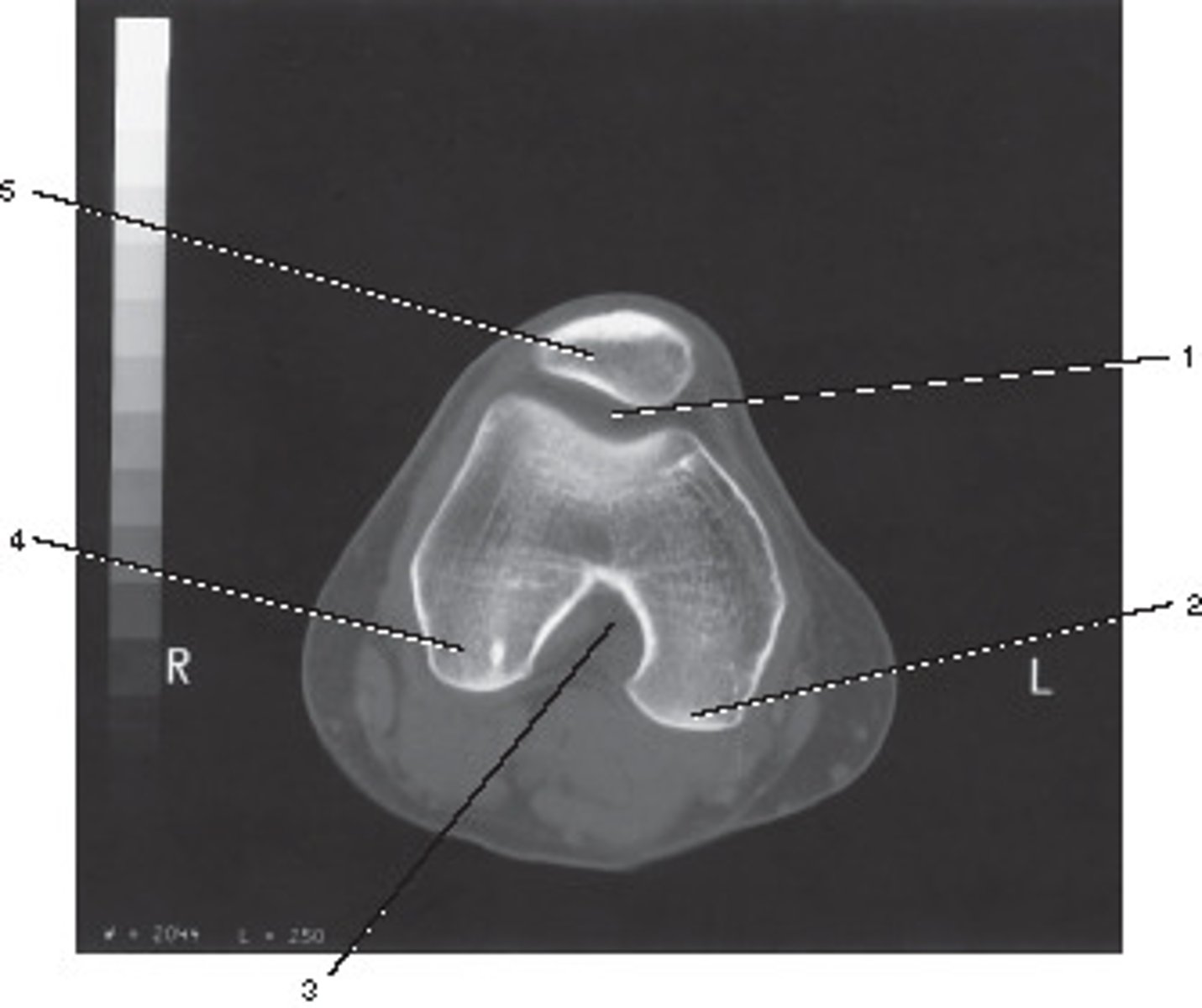<p>Number 4 corresponds to which of the following?</p>