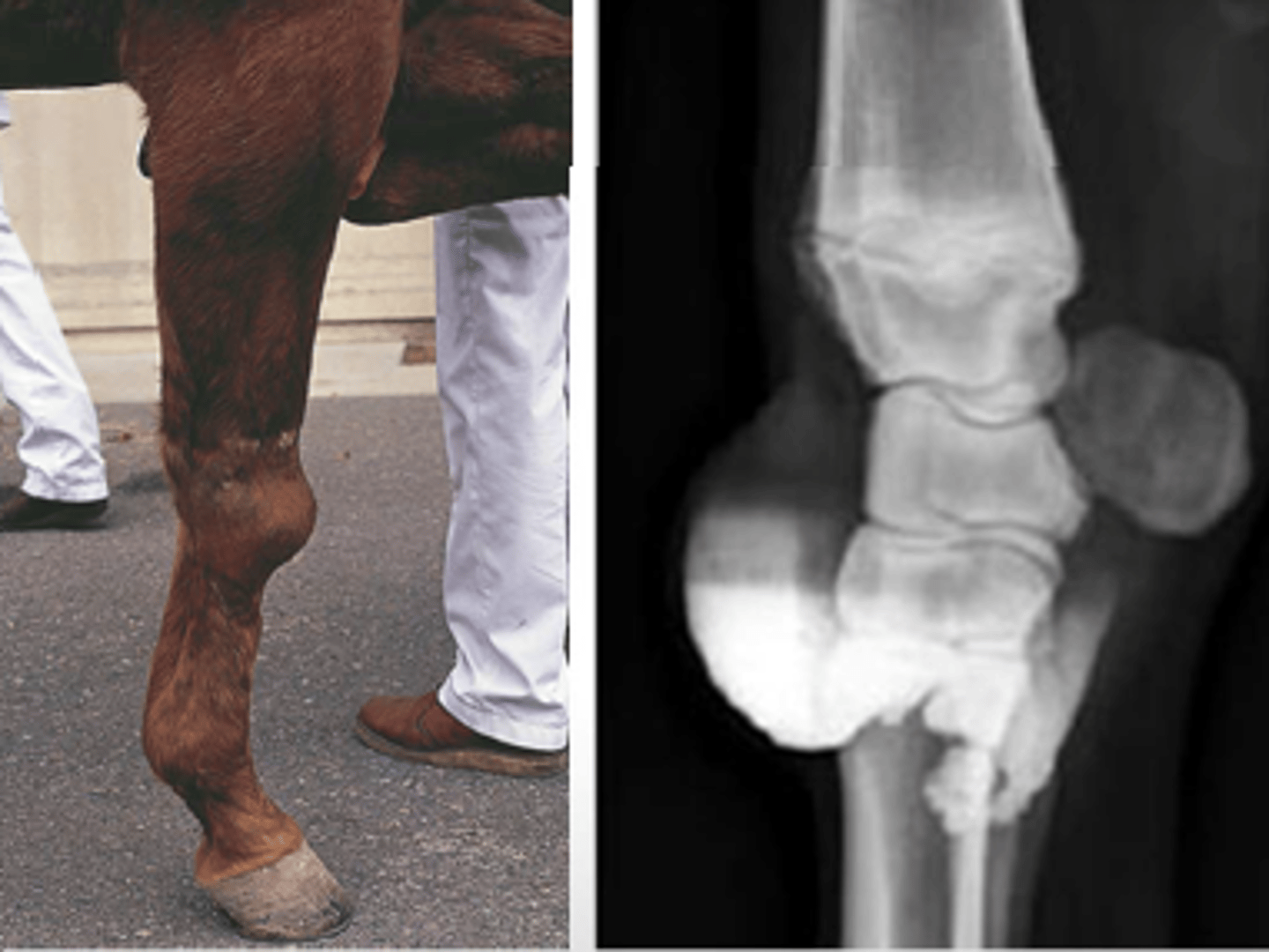<p>"Popped knees"</p><p>Traumatic bursitis of the carpus</p><p>Sudden onset due to strain/sprain on ligaments that hold carpal bones of knee in place</p><p>Damage to joint capsule --&gt; fluid fills area</p>