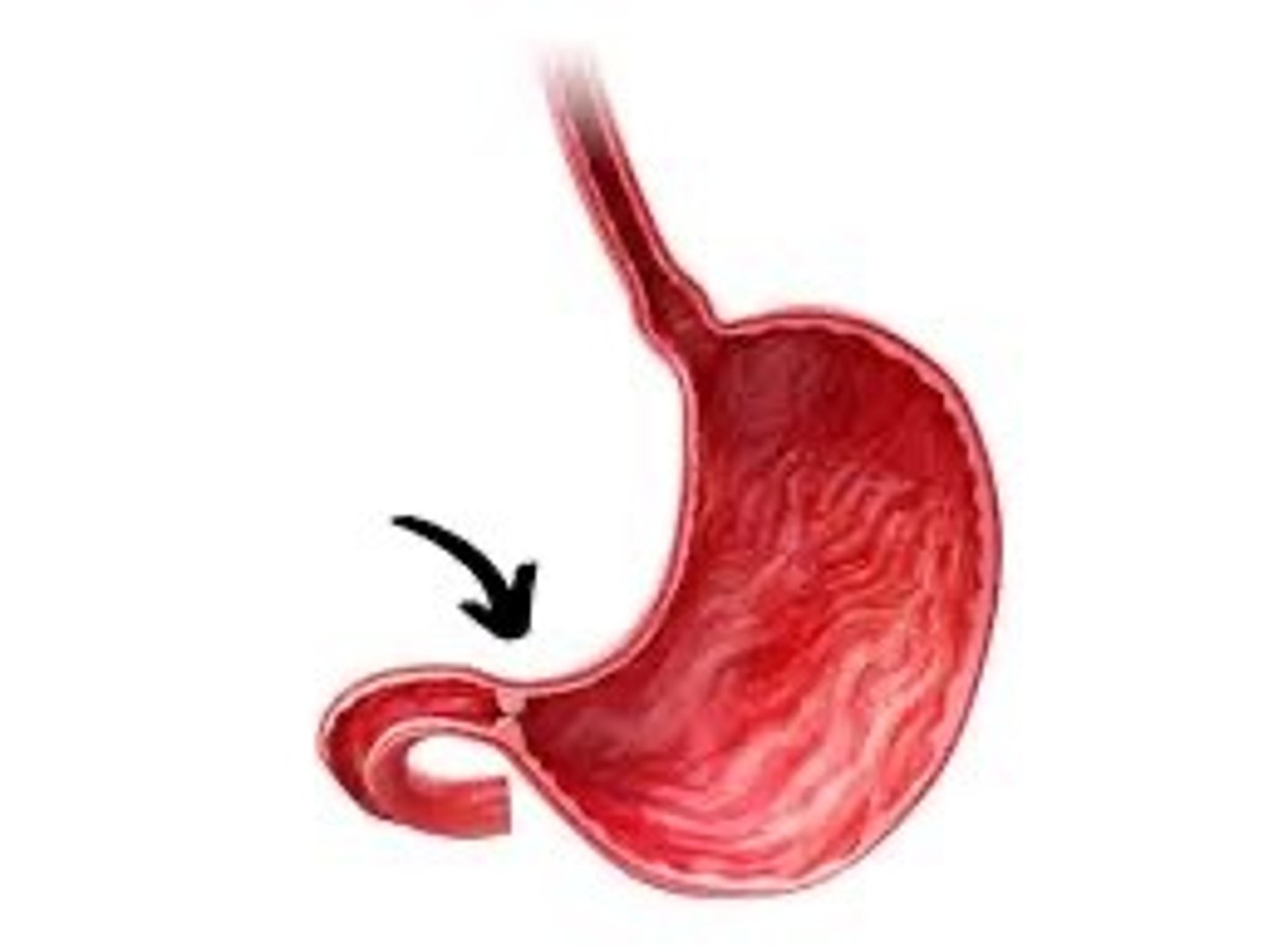 <p>Controls passage of food from stomach to small intestine(circular muscle)</p>