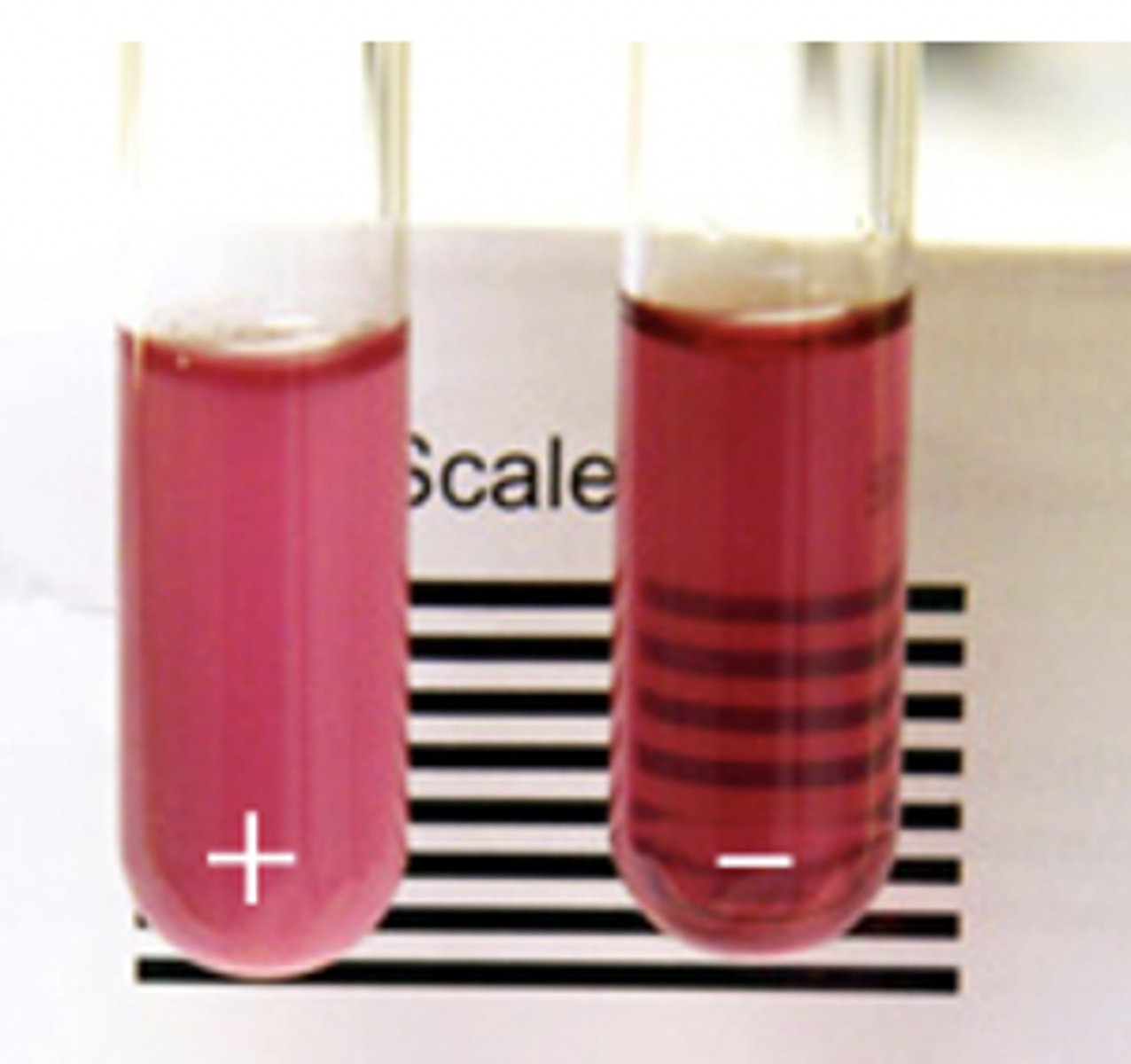 <p>1. insolubility of Hb S= Tactoids crystals<br>2. HPLC)</p>