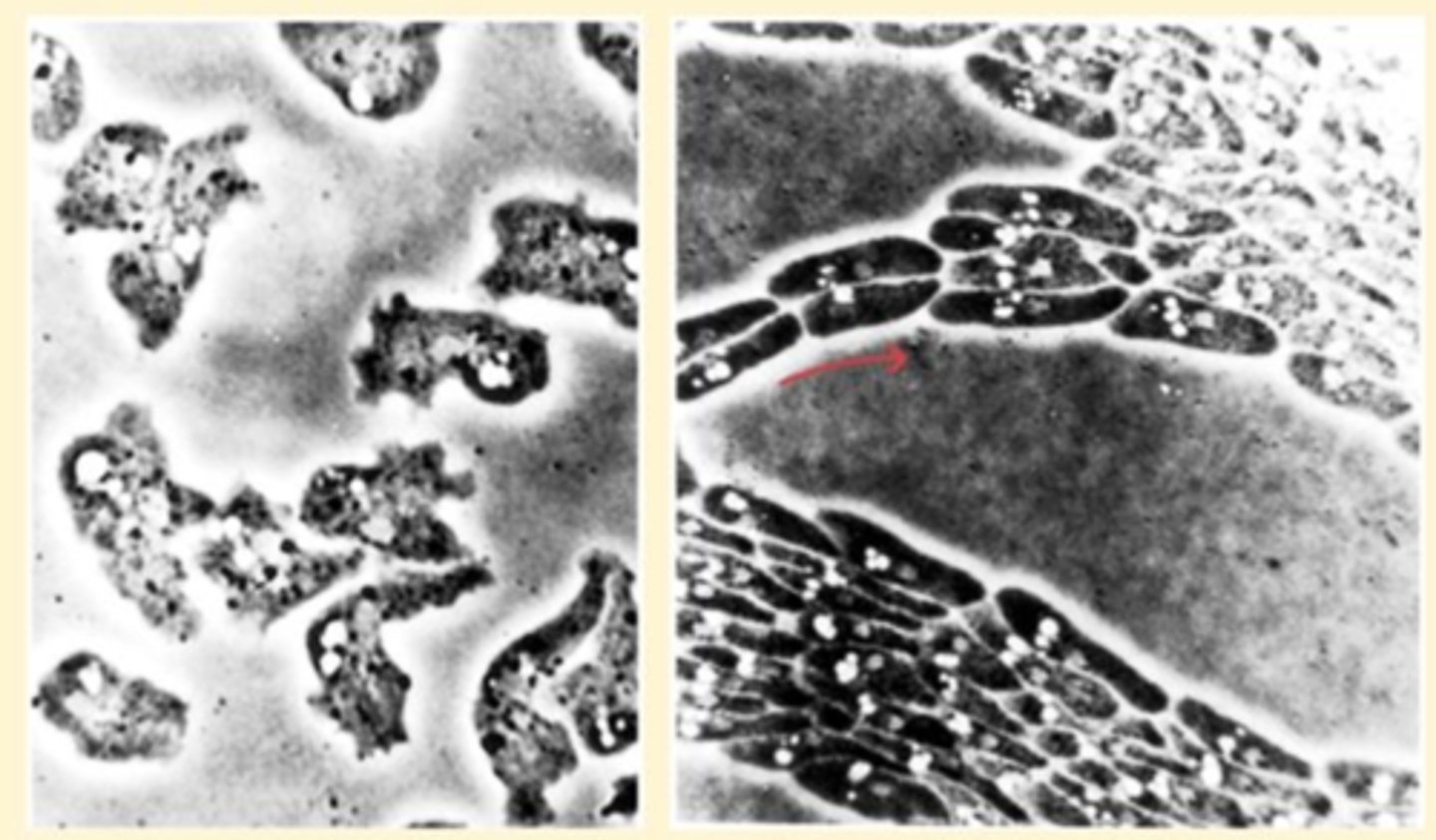 <p>An independent, unicellular, haploid life stage of cellular slime molds.</p>