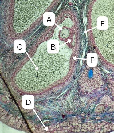 <p>What type of cells comprise A and B?</p>