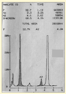 <p><span><span>1) Some patients have hereditary persistence of fetal Hb (HPFH) with HbF levels over 20%</span></span></p><p><span><span>2) These patients have fewer crises and a milder clinical phenotype</span></span></p><p><span><span>3) Understanding the biology of Hb genes might yield new therapies that increase HbF production</span></span></p><p></p>