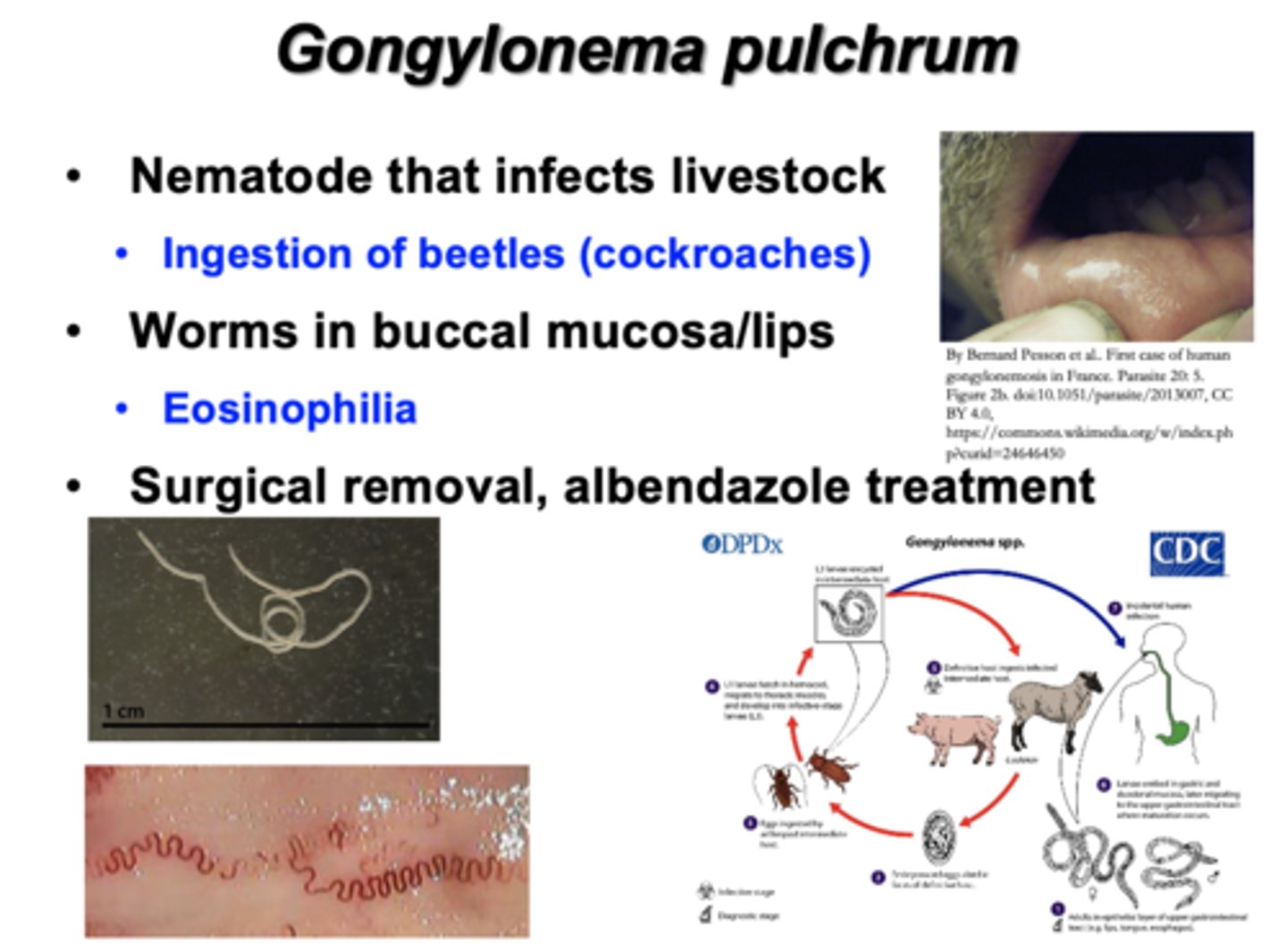 <p>•<strong>Nematode</strong> that infects livestock</p><p>--<span style="text-decoration:underline">Ingestion of beetles (cockroaches)</span></p><p></p><p>•<strong>Worms</strong> in buccal mucosa/lips</p><p>--<strong>Eosinophilia</strong></p><p></p><p>•<span style="text-decoration:underline">Surgical removal, albendazole treatment</span></p>