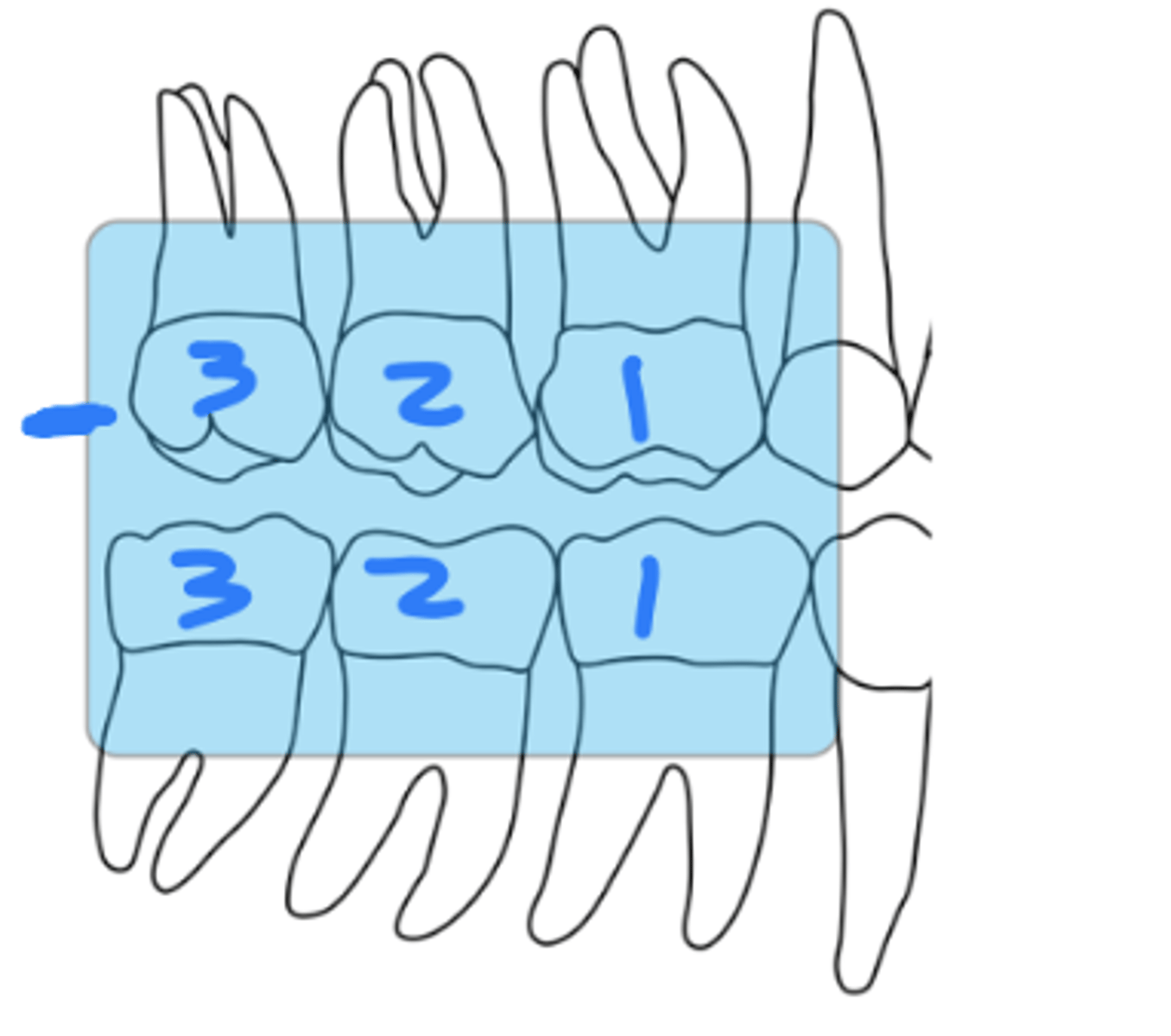 <p>size 2</p><p>proximal surfaces of all</p><p>erupted molars and 2-3 mm of bone distal to the last erupted molar</p>