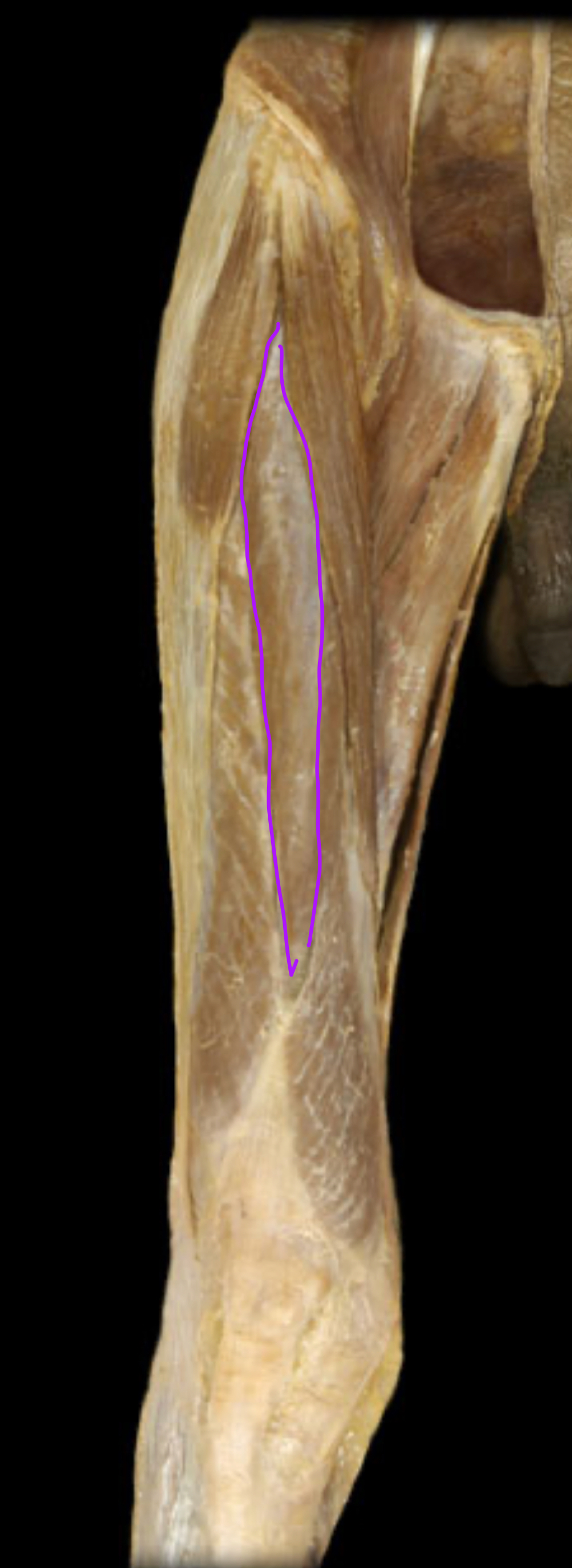 <p>Function?</p>