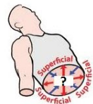 <p>Superficial</p>