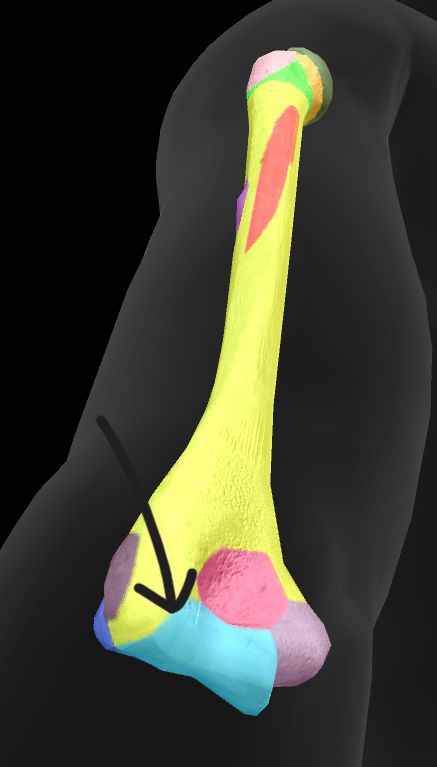 term image