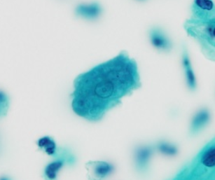 <p>Professor: Dr. Glena Fe A. Yapchulay-Alcabasa</p>