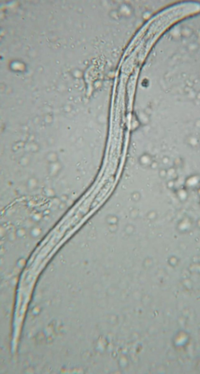 <p>What type of worm is this and what stage is it currently in?</p>