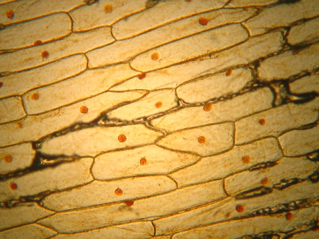 <p>The image below shows a section of onion epidermis which has been stained with Iodine.  What is the brown spherical structure within each cell?</p>
