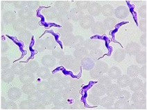 protist that causes African sleeping sickness