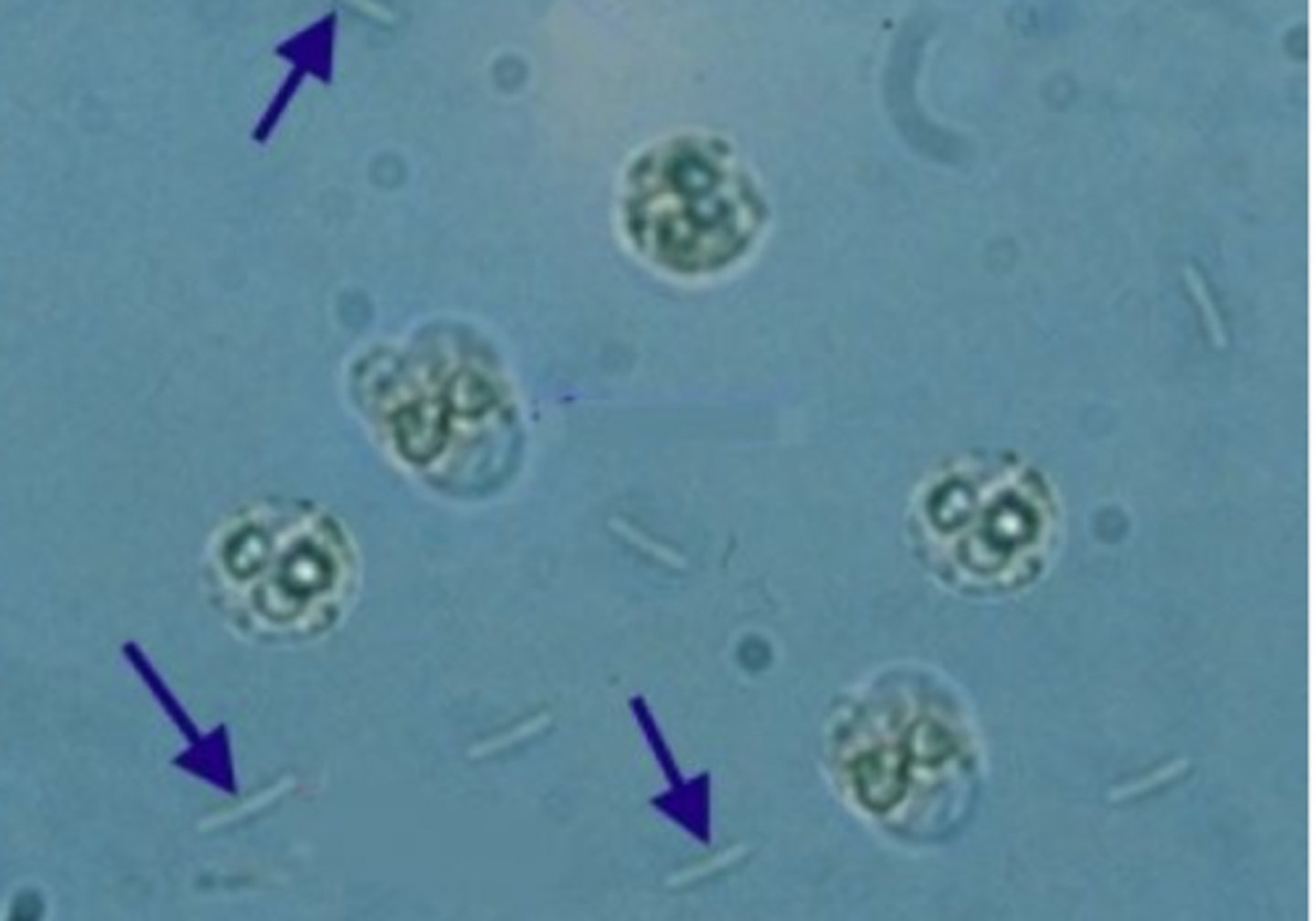 <p>may indicate a urinary tract infection. Still, it may also be contaminated if the specimen has been held at room temperature for a prolonged period and/or not collected using a clean-catch protocol. It is essential to perform a urinalysis on a freshly collected midstream specimen to determine the significance of the _____ that may be seen.</p>
