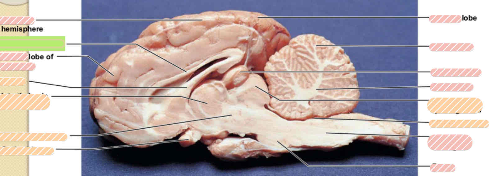 <p>Sheep brain</p>