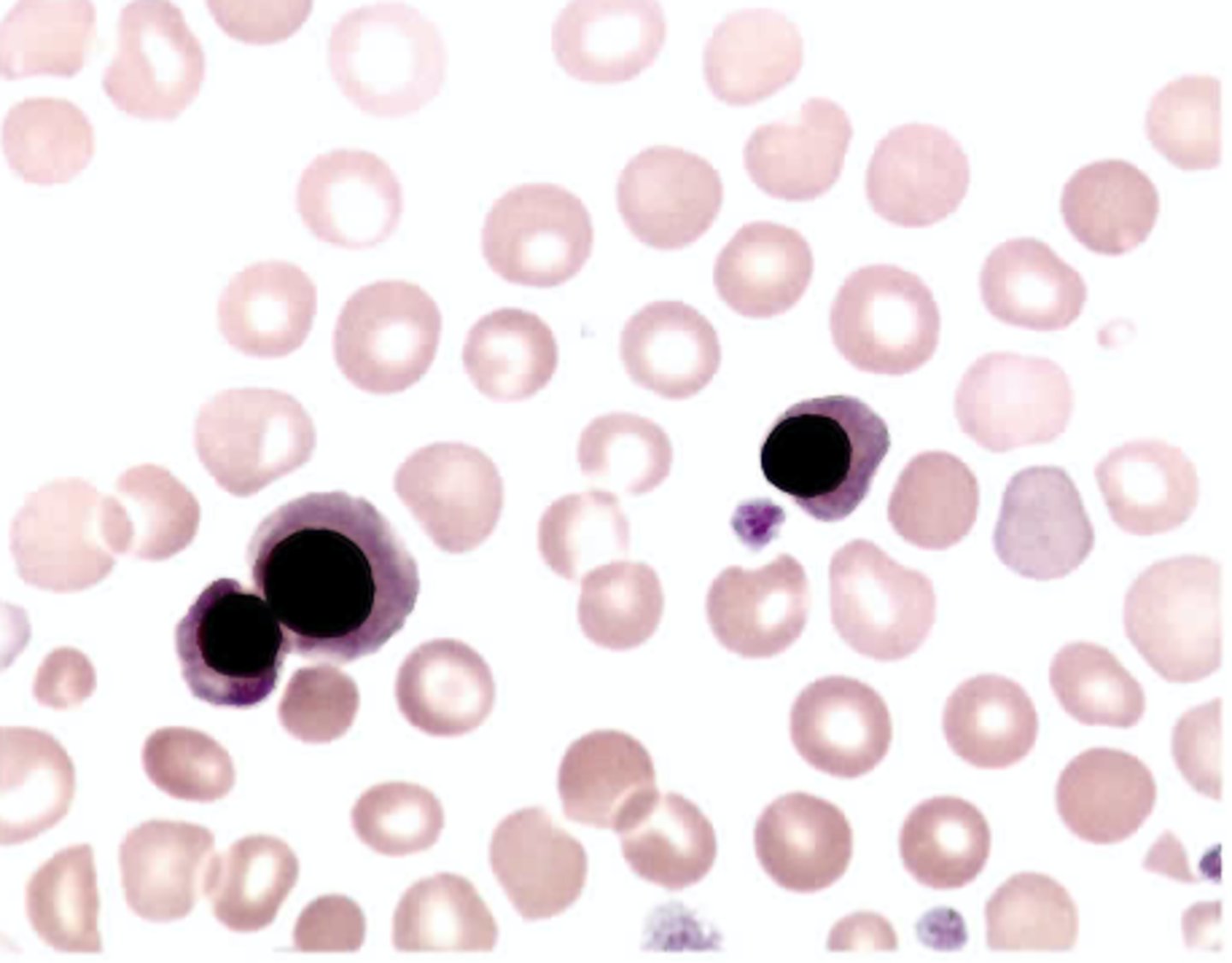 <p>C. Orthochromic normoblasts</p>