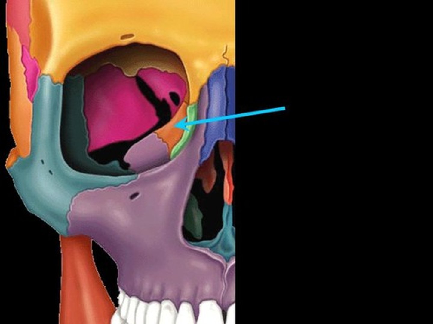 <p>forms part of the posterior portion of the nose, the orbit, and the floor of the cranium</p>